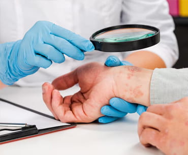 Multifocal polymorphous cutaneous tuberculosis with Poncet's disease