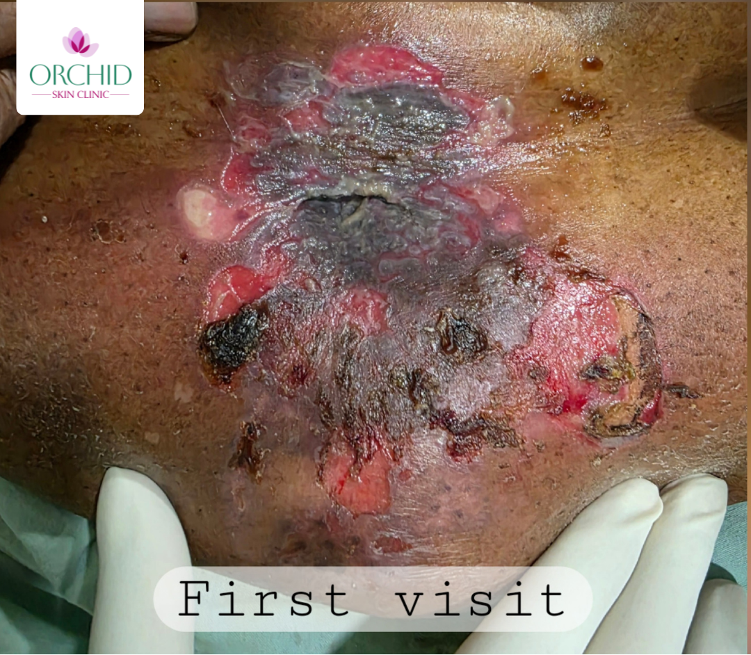 Before treatment clinical placeholder image from Unsplash