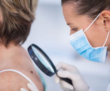 Post Herpes Zoster Comedones