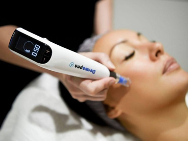 Microneedling